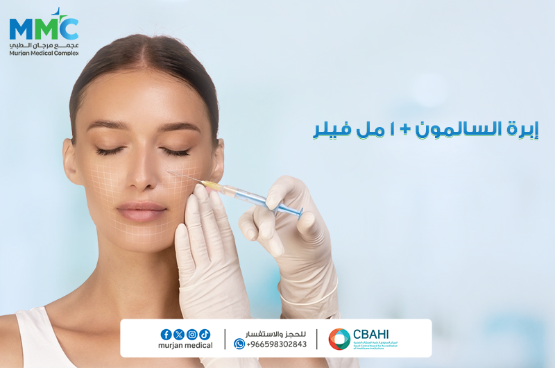 ابرة السالمون +1مل فلير