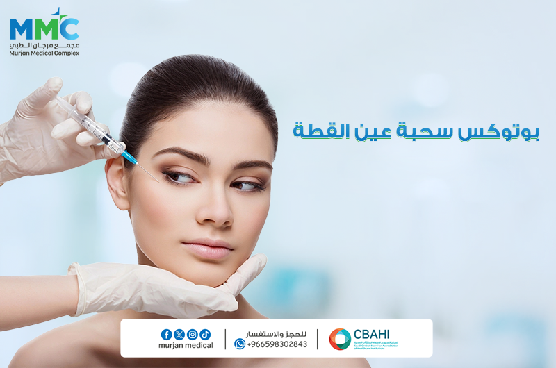 بوتوكس سحبه عين القطة