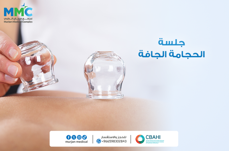 حجامه جافه