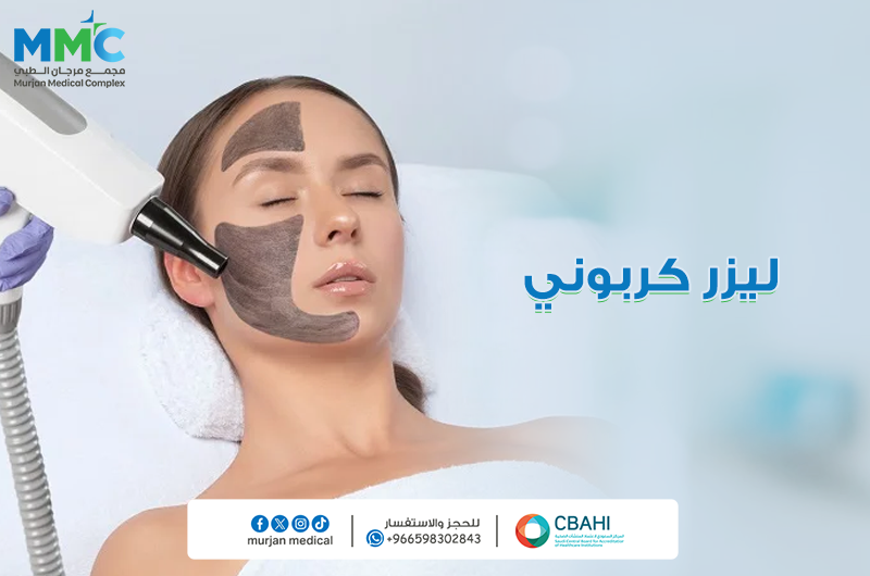 ليزر كربوني
