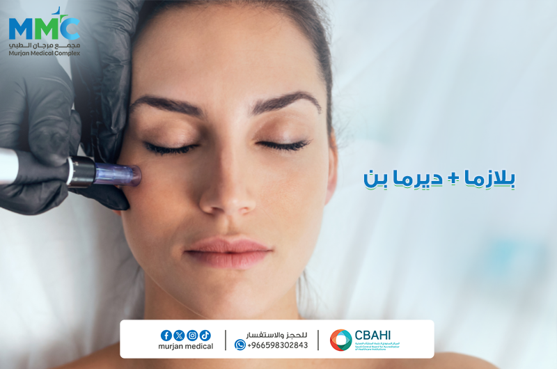 بلازما وديرمابن