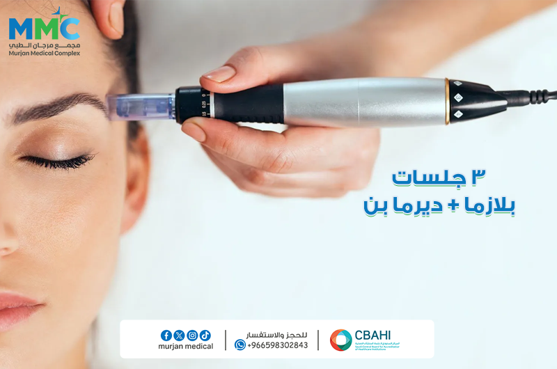 3 بلازما وديرمابن