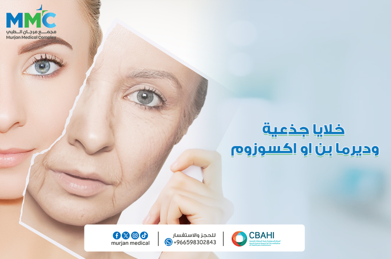 خلايا جذعيه وديرما او اكسوزوم
