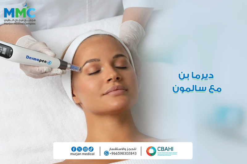 ديرمابن مع السالمون