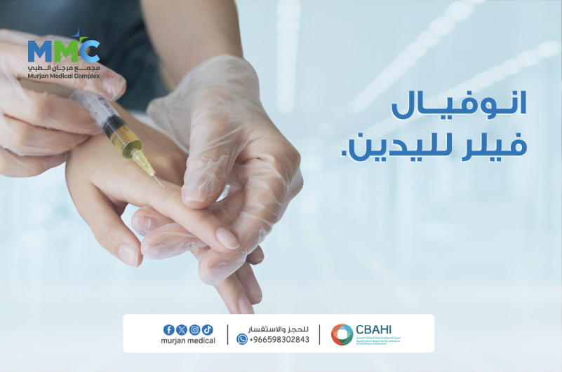 انوفيال فيلر اليدين